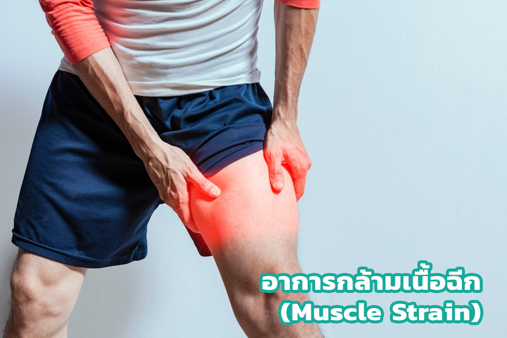 อาการกล้ามเนื้อฉีก (Muscle Strain)